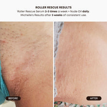 Load image into Gallery viewer, Roller Rescue Ingrown Hair Soothing Serum