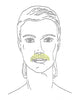 Extended Chin & Upper Lip Combo