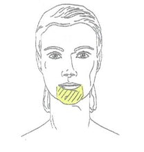 Load image into Gallery viewer, Upper Lip and Chin Combo