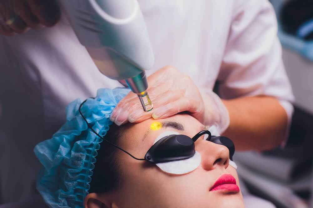 Tattoo Removal Eyebrows