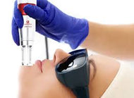 Non Ablative Fractional Skin Resurfacing