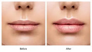 Lip Flip