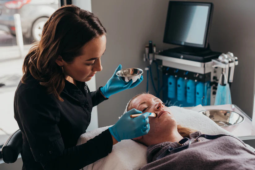 Chemical Peel Level 1