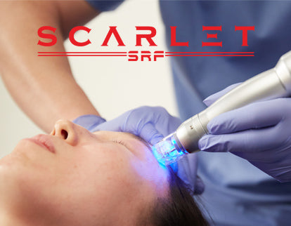 Scarlet SRF RF Microneedling – Vernon Smooth Effects