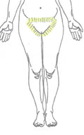 Full Bikini Laser Hair Removal