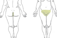 Brazilian and Underarm Combo Laser Hair Removal
