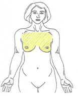Chest Laser Hair Removal