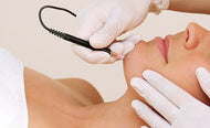 Electrolysis