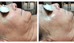 Firming Peptide Facial