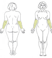 Forearms Laser Hair Removal