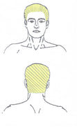 Head Laser Hair Removal
