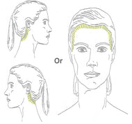Hairline Laser Hair Removal