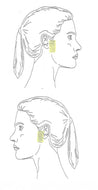 Sideburns Laser Hair Removal