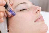 Micro Needling - Face