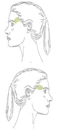 Temples Laser Hair Removal
