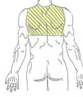 Upper Back Laser Hair Removal