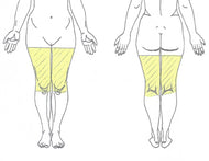 Upper Legs Laser Hair Removal